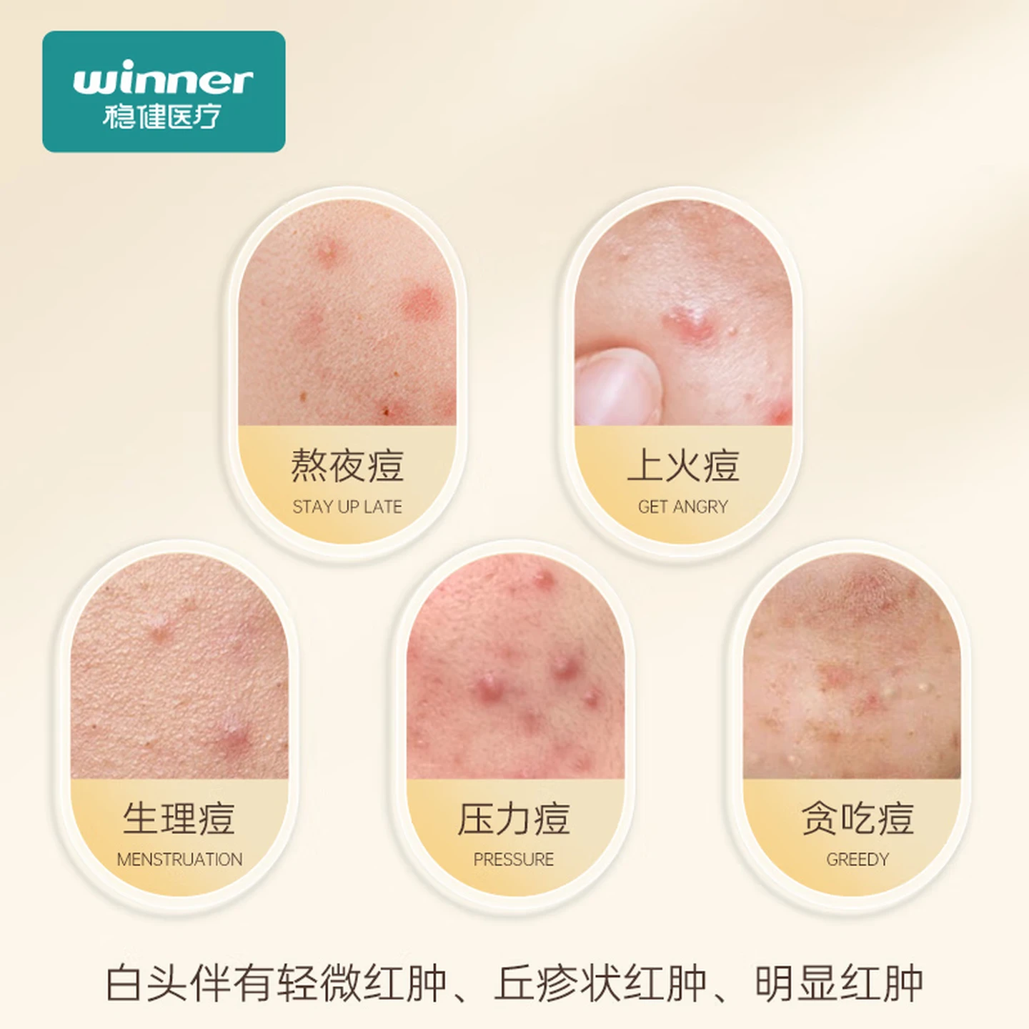 Winner Medical Microcrystal Acne Patches, Targeted Spot Treatment, Invisible, 9 Patches/Box